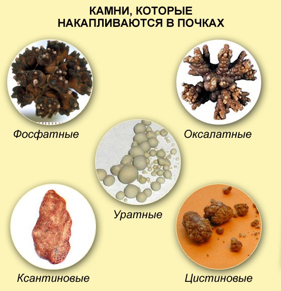 kamnjah-v-pochkah