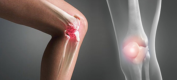 rheumatology